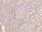 SNRNP200 Polyclonal Antibody